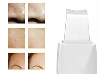 Thumbnail for Ariko Ultrasoon Face Huidverjongingsapparaat – Blackhead remover - Skin scrubber - Wit - Mee Eter Verwijderaar - Gezichtsreiniger - Puisten - Verzacht rimpels - Anti Acne - Ultrasonic Spatel - Reiniging, Hydratatie & Versteviging - drie standen