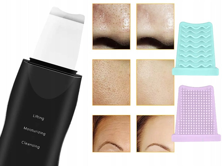 Ariko Ultrasoon Face Huidverjongingsapparaat – Blackhead remover - Skin scrubber - Zwart - Comedonenlepel - Mee Eter Verwijderaar - Gezichtsreiniger - Puisten - Verzacht rimpels - Anti Acne - Ultrasonic Spatel - Reiniging, Hydratatie & Versteviging