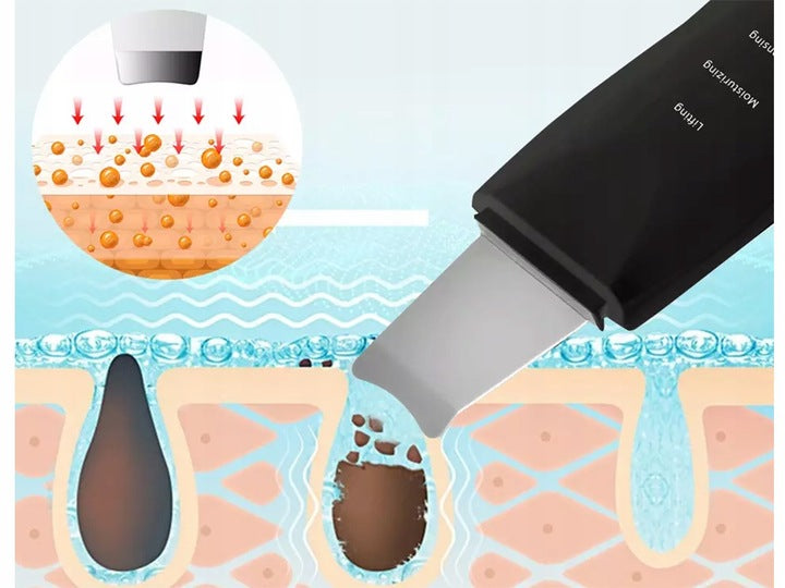 Ariko Ultrasoon Face Huidverjongingsapparaat – Blackhead remover - Skin scrubber - Zwart - Comedonenlepel - Mee Eter Verwijderaar - Gezichtsreiniger - Puisten - Verzacht rimpels - Anti Acne - Ultrasonic Spatel - Reiniging, Hydratatie & Versteviging