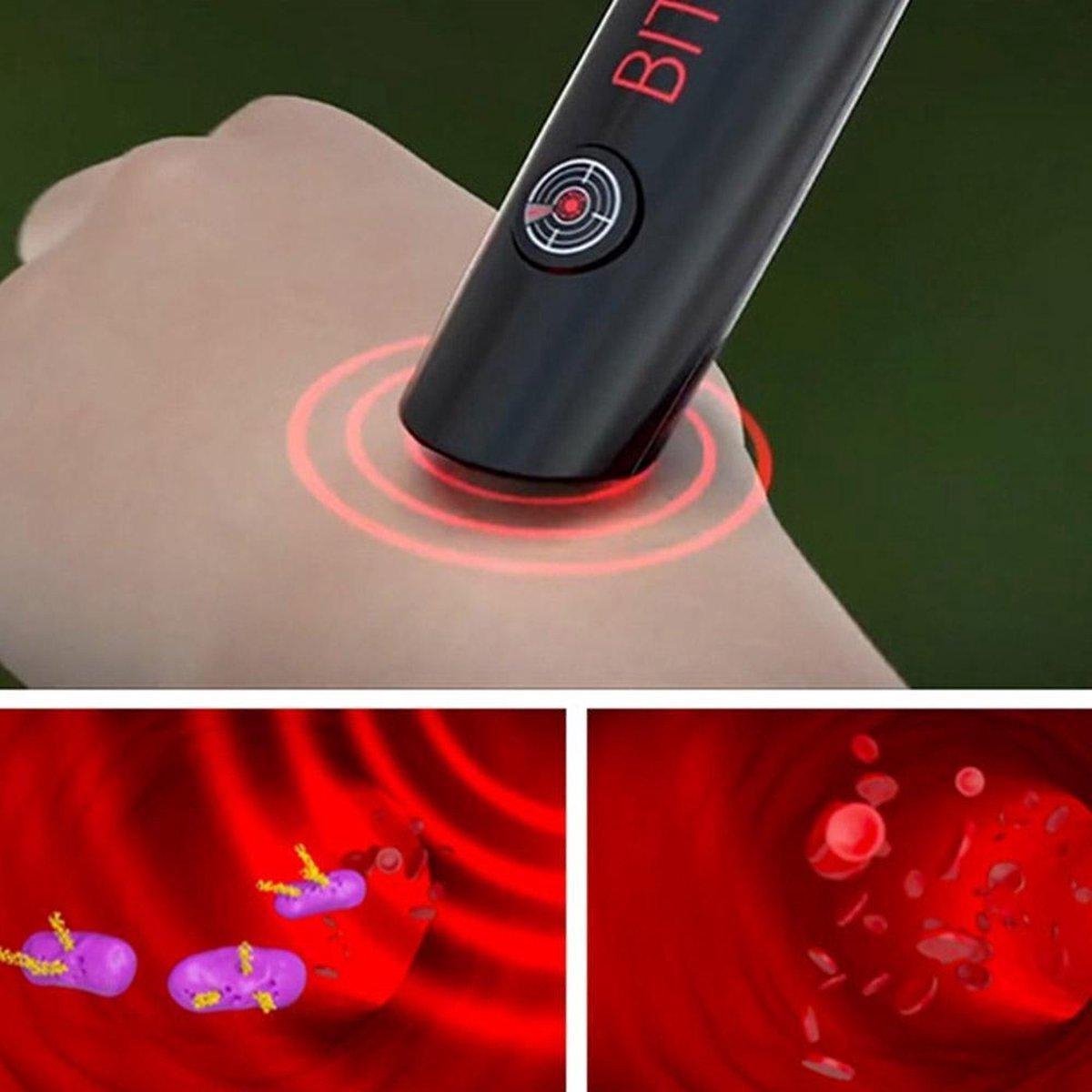Ariko Bite Help Mückenstich Stift Insektenstich Schmerzlinderung Juckreiz lindern Mückenstift Mückenstich Mückenstich