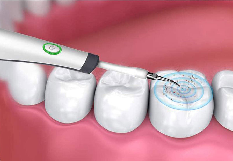 <tc>Ariko</tc> Ultrasonic tartar remover - extra attachments - 15,000 revolutions per minute - Including batteries